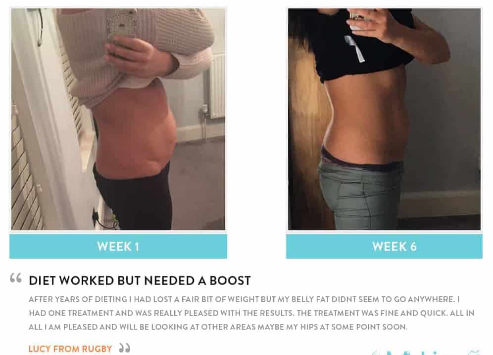 Before and After Dieting Stoke