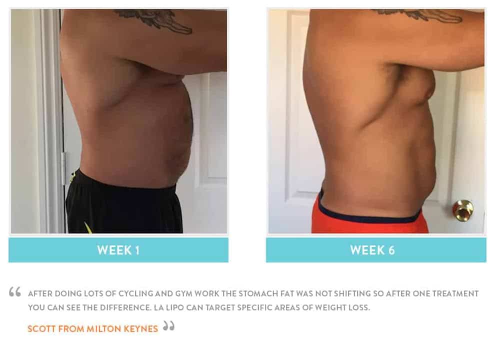 Before & After Stomach Fat Stoke
