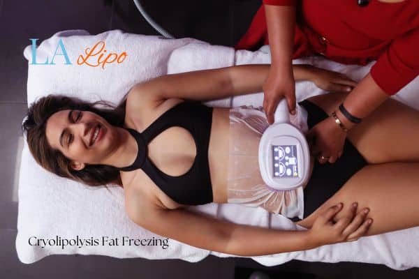 woman getting cryolipolysis Stoke