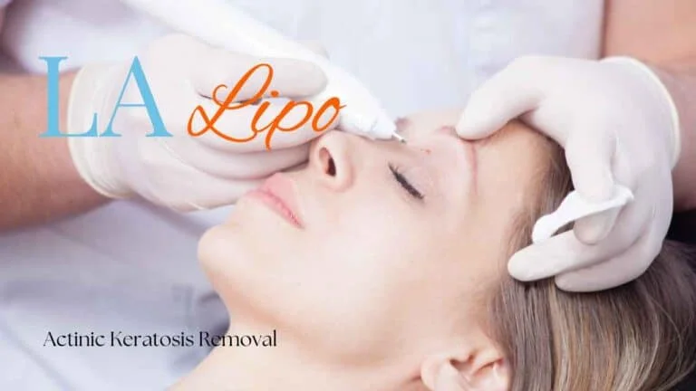 Woman receiving Actinic Keratosis Removal Treatment Stoke