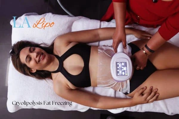 woman getting cryolipolysis Stoke