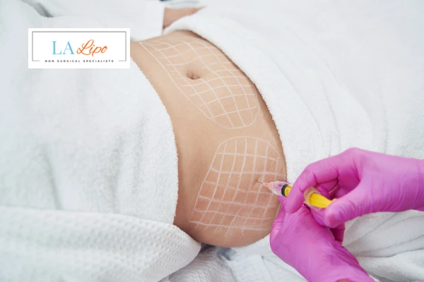 aqualyx fat dissolving injections Stoke