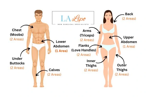 LA LIPO Cryolipolysis Areas Stoke