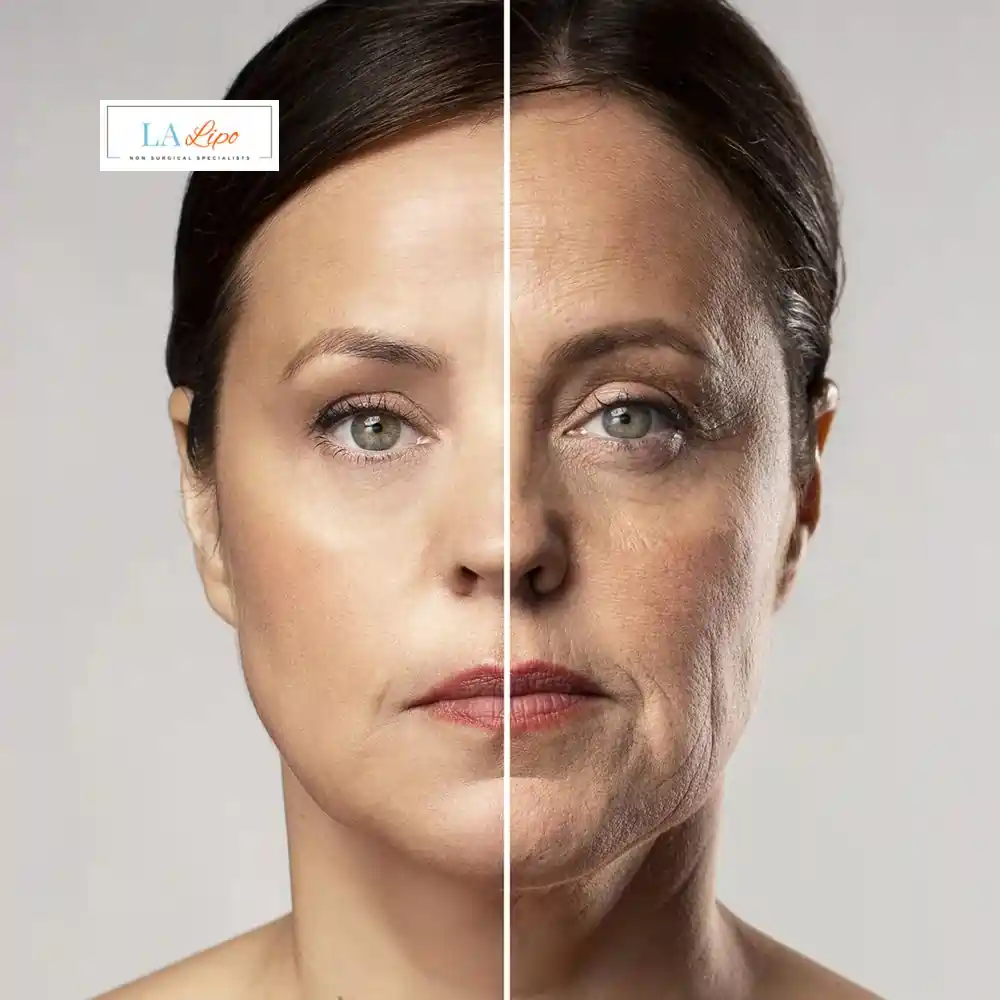 How Can You Tell If Non-Surgical Skin Tightening Is Right for You Stoke?