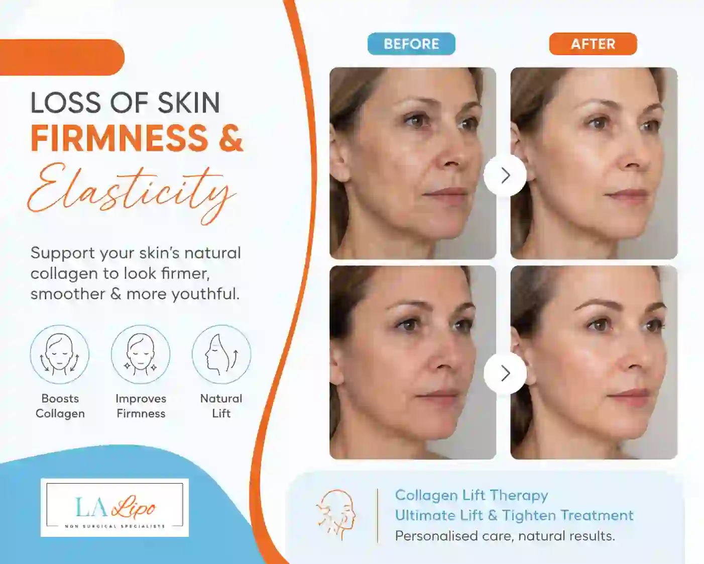 Sign #7: Loss of Skin Firmness and Elasticity Stoke