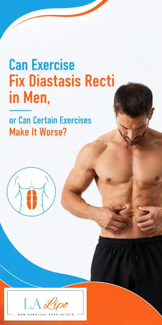 Can Exercise Fix Diastasis Recti in Men, or Can Certain Exercises Make It Worse Stoke?